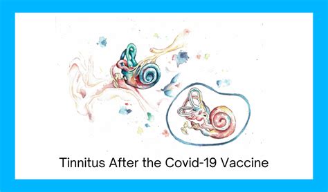 Also taking uva ursi, allicin, clove, and natural zeolite to help my dysbiosis. . Will tinnitus from covid vaccine go away